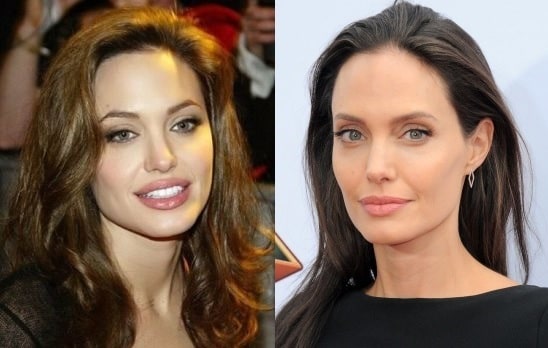 A picture of Angelina Jolie before (left) and after (right).